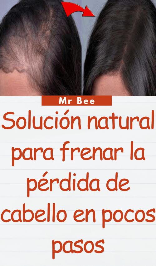 image-cabello-103024-15