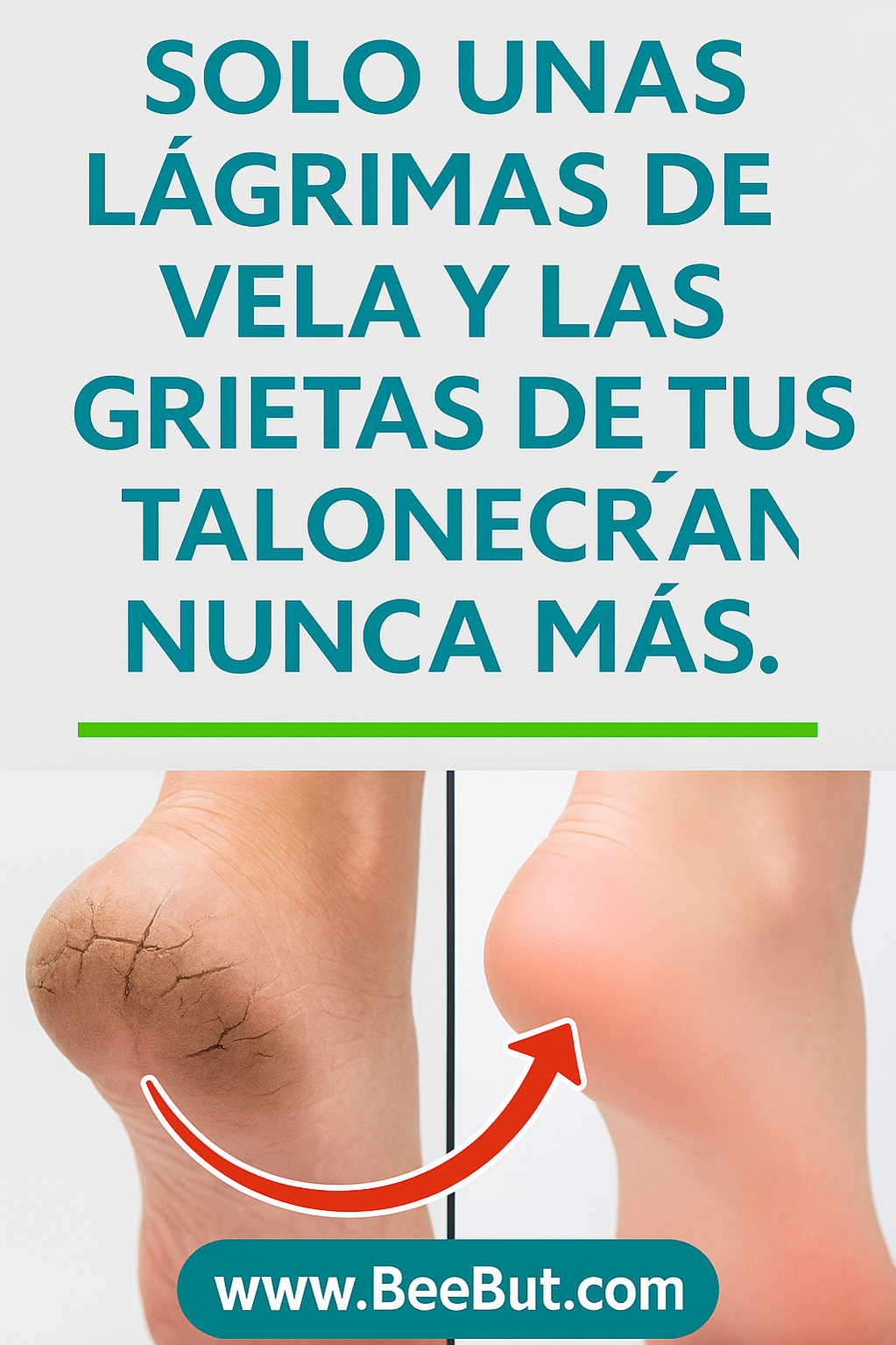 Remedio casero para talones agrietados